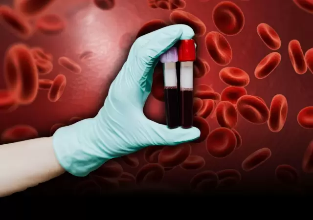 Hospital Posadas detecta el rar�simo grupo sangu�neo Herbich en Argentina