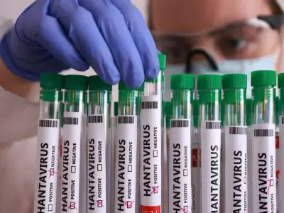 La variante Andes genera alarma nacional por su letalidad y r�cord de contagios.