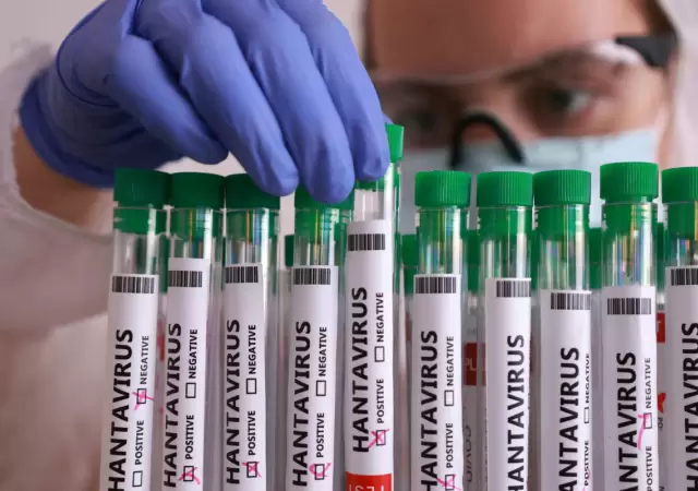 La variante Andes genera alarma nacional por su letalidad y r�cord de contagios.